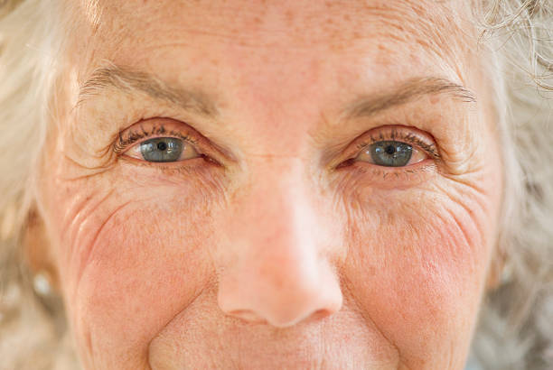 Visage de femme âgée aux yeux bleus, avec des taches brunes sur la peau